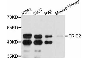 Western blot analysis of extracts of various cell lines, using TRIB2 antibody (ABIN4905491) at 1:3000 dilution. (TRIB2 Antikörper)