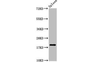 Western Blot Positive WB detected in: Rat spleen tissue All lanes: H1F0 antibody at 0. (Histone H1-Like (LOC107807853) Antikörper)