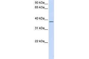 WB Suggested Anti-C21orf91 Antibody Titration:  0. (C21orf91 Antikörper  (Middle Region))