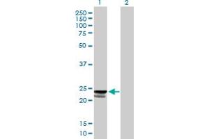 Western Blot analysis of C9orf115 expression in transfected 293T cell line by C9orf115 MaxPab polyclonal antibody. (PTRH1 Antikörper  (AA 1-214))
