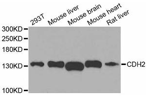 Western blot analysis of extracts of various cell lines, using CDH2 antibody (ABIN5995676) at 1/1000 dilution. (N-Cadherin Antikörper)