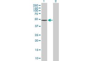 Western Blot analysis of CD177 expression in transfected 293T cell line by CD177 MaxPab polyclonal antibody. (CD177 Antikörper  (AA 1-437))