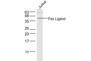 Image no. 5 for anti-Fas Ligand (TNF Superfamily, Member 6) (FASL) (AA 196-281) antibody (ABIN726410)