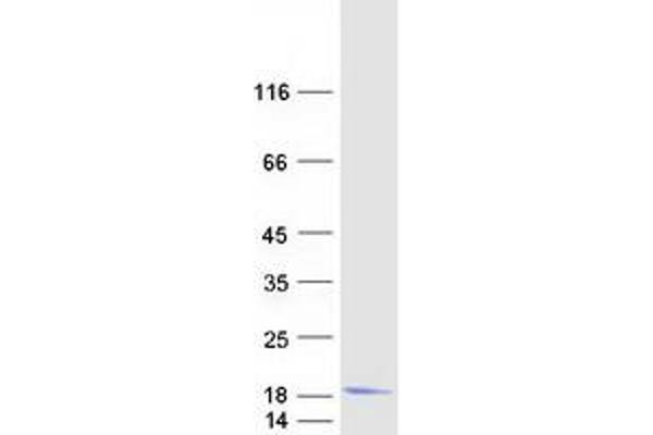 Hemoglobin, mu Protein (Myc-DYKDDDDK Tag)