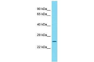Host: Rabbit Target Name: MSANTD1 Sample Type: 721_B Whole Cell lysates Antibody Dilution: 1. (MSANTD1 Antikörper  (C-Term))