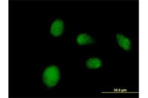 Immunofluorescence of purified MaxPab antibody to NANP on HeLa cell. (NANP Antikörper  (AA 1-248))
