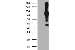 HEK293T cells were transfected with the pCMV6-ENTRY control (Left lane) or pCMV6-ENTRY PFKP (Right lane) cDNA for 48 hrs and lysed. (PFKP Antikörper)