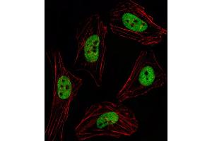 Fluorescent image of Hela cell stained with PITX2 Antibody . (PITX2 Antikörper  (AA 122-151))