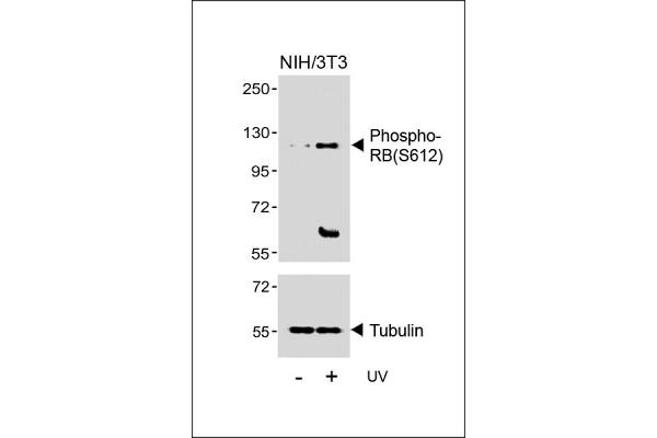 Retinoblastoma 1 Antikörper  (pSer612)