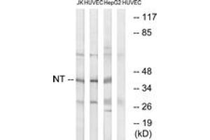 Western blot analysis of extracts from HuvEc/HepG2/Jurkat cells, using NT Antibody. (NT (AA 235-284) Antikörper)