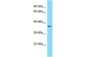 Host: Rabbit Target Name: OR51B6 Sample Type: ACHN Whole Cell lysates Antibody Dilution: 1. (OR51B6 Antikörper  (C-Term))