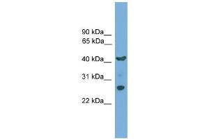 WB Suggested Anti-TMEM176A Antibody Titration:  0. (TMEM176A Antikörper  (N-Term))