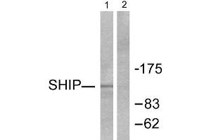 Western Blotting (WB) image for anti-Inositol Polyphosphate-5-Phosphatase, 145kDa (INPP5D) (C-Term) antibody (ABIN1848769) (INPP5D Antikörper  (C-Term))