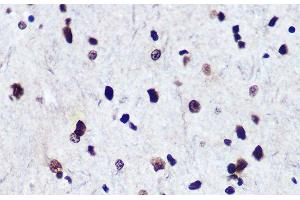 Immunohistochemistry of paraffin-embedded Rat brain using Phospho-Smad2(S465/467)/Smad3(S423/425) Polyclonal Antibody at dilution of 1:100 (40x lens). (SMAD2 Antikörper  (pSer423, pSer425, pSer465, pSer467))