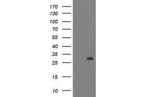 HEK293T cells were transfected with the pCMV6-ENTRY control (Left lane) or pCMV6-ENTRY PGAM2 (Right lane) cDNA for 48 hrs and lysed. (PGAM2 Antikörper)