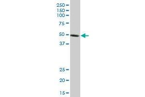 KLF10 monoclonal antibody (M14), clone 2E7. (KLF10/TIEG1 Antikörper  (AA 111-210))