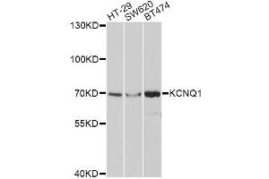 Western blot analysis of extracts of various cell lines, using KCNQ1 antibody (ABIN5971201) at 1/1000 dilution. (KCNQ1 Antikörper)