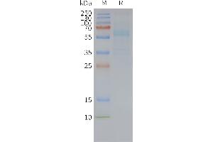 Human -Nanodisc, Flag Tag on SDS-PAGE (FZD7 Protein)