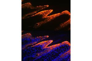 Immunofluorescence analysis of human skin using Cytokeratin 10 Rabbit mAb (ABIN1679404, ABIN3019133, ABIN3019134 and ABIN7101721) at dilution of 1:100 (40x lens). (Keratin 10 Antikörper)