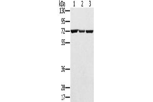 Western Blotting (WB) image for anti-Solute Carrier Family 25, Member 13 (Citrin) (slc25a13) antibody (ABIN2424162) (slc25a13 Antikörper)