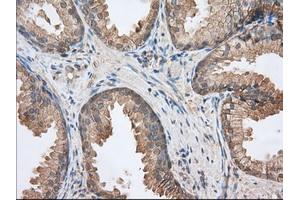 Immunohistochemical staining of paraffin-embedded Human Kidney tissue using anti-BSG mouse monoclonal antibody. (CD147 Antikörper)