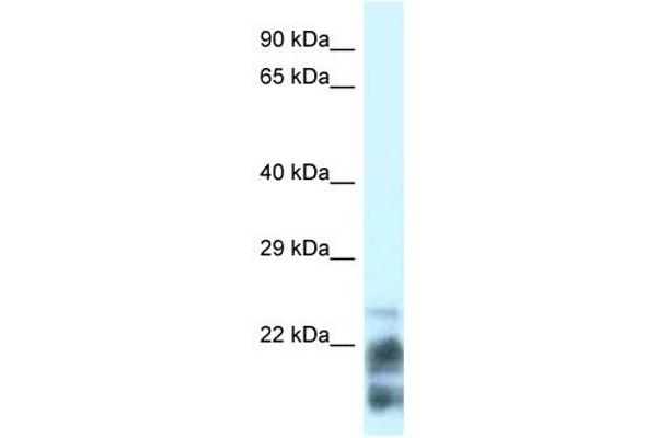 MDP1 Antikörper  (N-Term)