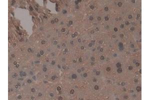 DAB staining on IHC-P; Samples: Mouse Liver Tissue (TNP1 Antikörper  (AA 3-53))