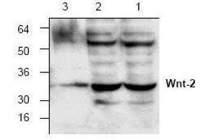 Image no. 1 for anti-Wingless-Type MMTV Integration Site Family Member 2 (WNT2) antibody (ABIN127198) (WNT2 Antikörper)