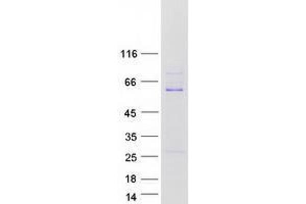 ZSCAN21 Protein (Myc-DYKDDDDK Tag)