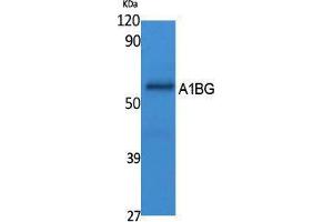 Western Blotting (WB) image for anti-alpha-1-B Glycoprotein (A1BG) (Internal Region) antibody (ABIN3178089) (A1BG Antikörper  (Internal Region))