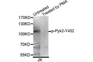 Western blot analysis of extracts of Jurkat cell line, using Phospho-Pyk2-Y402 antibody. (PTK2B Antikörper  (pTyr402))