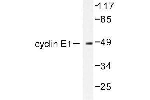 Image no. 1 for anti-Cyclin E1 (CCNE1) antibody (ABIN265379) (Cyclin E1 Antikörper)