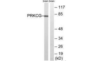 Western blot analysis of extracts from Rat brain cells, using PRKCG(Ab-655) antibody. (PKC gamma Antikörper  (Thr655))