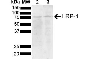 Western blot analysis of Mouse, Rat Brain showing detection of 504. (LRP1 Antikörper  (AA 160-260) (PE))