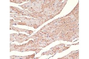 Immunohistochemistry of paraffin-embedded Mouse heart using ADRA1A Polyclonal Antibody at dilution of 1:100 (40x lens). (alpha 1 Adrenergic Receptor Antikörper)