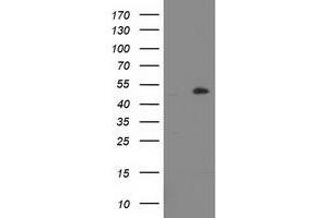 HEK293T cells were transfected with the pCMV6-ENTRY control (Left lane) or pCMV6-ENTRY LPL (Right lane) cDNA for 48 hrs and lysed. (Lipoprotein Lipase Antikörper)