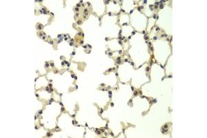 Immunohistochemistry of paraffin-embedded mouse lung using FBXW11 antibody. (FBXW11 Antikörper)