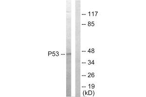 Western blot analysis of extracts from HepG2 cells, using p53 antibody. (p53 Antikörper  (C-Term))