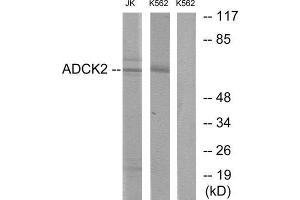 Western Blotting (WB) image for anti-AarF Domain Containing Kinase 2 (ADCK2) (Internal Region) antibody (ABIN1849735) (ADCK2 Antikörper  (Internal Region))