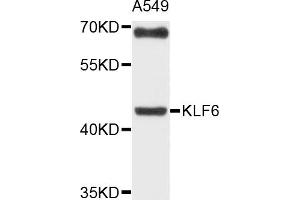 Western blot analysis of extracts of A-549 cells, using KLF6 antibody (ABIN4904165) at 1:1000 dilution. (KLF6 Antikörper)