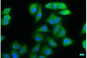 Immunofluorescence staining of Hela cells with ABIN7165849 at 1:66, counter-stained with DAPI. (NDRG1 Antikörper  (AA 136-394))