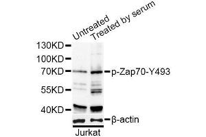 Western blot analysis of extracts of Jurkat cells, using Phospho-ZAP70-Y493 antibody (ABIN2988352) at 1/1000 dilution. (ZAP70 Antikörper  (pTyr493))