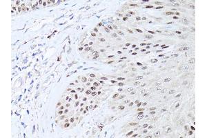 Immunohistochemistry of paraffin-embedded human skin using TP63 antibody. (TCP1 alpha/CCTA Antikörper)