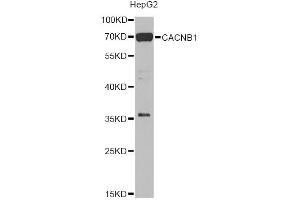 Western blot analysis of extracts of HepG2 cells, using CACNB1 Antibody (ABIN2736384) at 1:1000 dilution. (CACNB1 Antikörper)