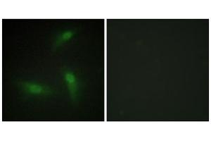 Immunofluorescence analysis of HeLa cells, using hnRNP A1 antibody. (HNRNPA1 Antikörper  (Internal Region))