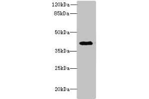 Western blot All lanes: DCN antibody at 6 μg/mL + Jurkat whole cell lysate Secondary Goat polyclonal to rabbit IgG at 1/10000 dilution Predicted band size: 40 kDa Observed band size: 40 kDa (Decorin Antikörper  (AA 31-360))