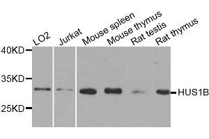 Western blot analysis of extracts of various cell lines, using HUS1B antibody. (HUS1B Antikörper  (AA 1-278))