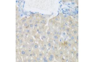 Immunohistochemistry of paraffin-embedded mouse liver using EGFR antibody (ABIN5997650) at dilution of 1/100 (40x lens). (EGFR Antikörper)