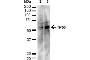 Western blot analysis of Human HeLa and HEK293T cell lysates showing detection of ~43. (p53 Antikörper  (C-Term) (HRP))