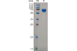 Human Protein, hFc Tag on SDS-PAGE under reducing condition. (BST1 Protein (AA 29-292) (Fc Tag))